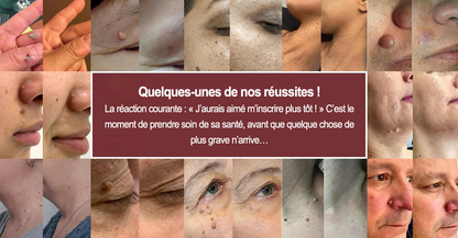 🏥 Curalona® Patch Invisible 2-en-1 🍀 | Cible les acrochordons, verrues planes et petites imperfections visibles | Micro-aiguilles + hydrocolloïde | Sans coupure • Sans congélation • Visage & corps