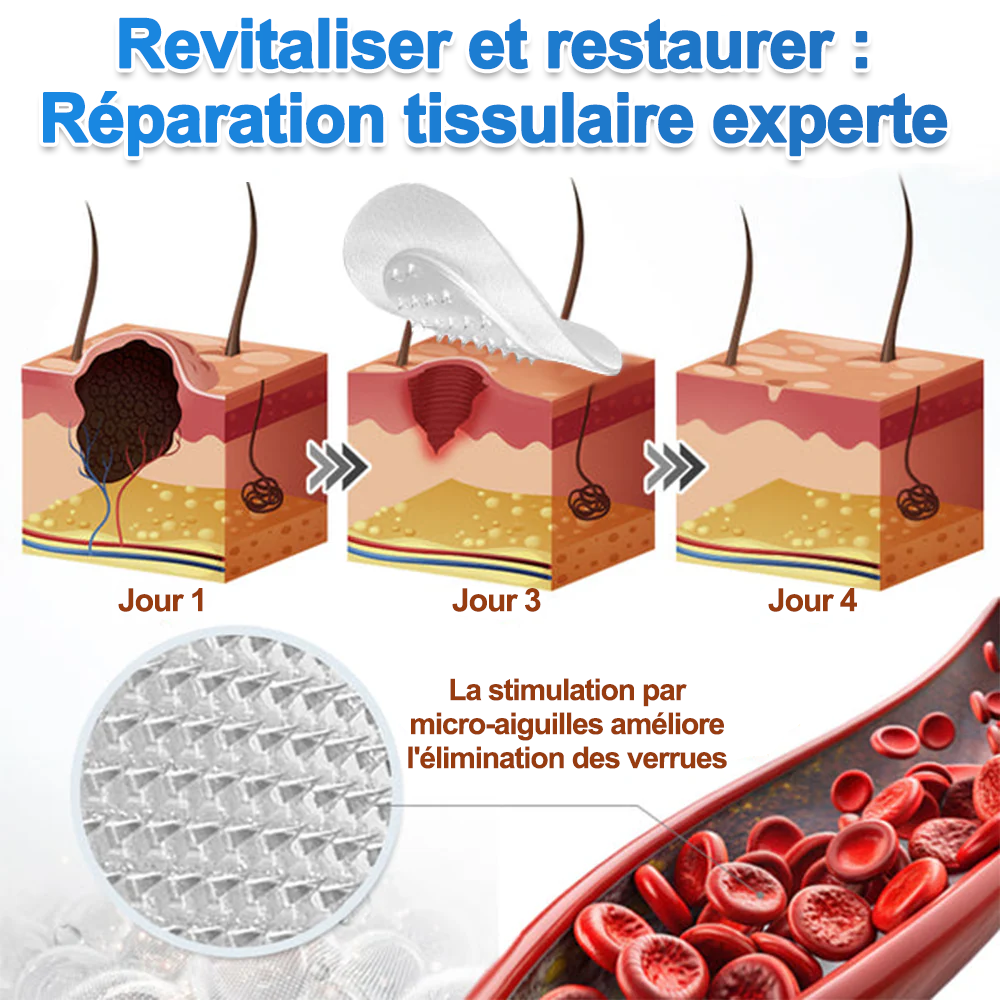 🏥 Curalona® Patch Invisible 2-en-1 🍀 | Cible les acrochordons, verrues planes et petites imperfections visibles | Micro-aiguilles + hydrocolloïde | Sans coupure • Sans congélation • Visage & corps