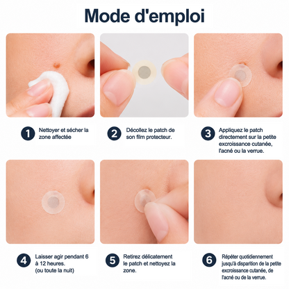 🏥 Curalona® Patch Invisible 2-en-1 🍀 | Cible les acrochordons, verrues planes et petites imperfections visibles | Micro-aiguilles + hydrocolloïde | Sans coupure • Sans congélation • Visage & corps
