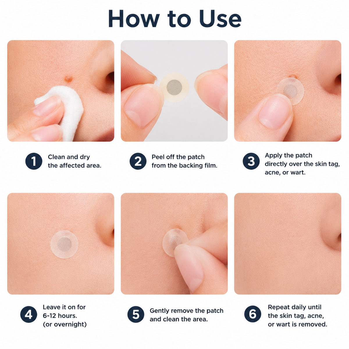 🏥 Curalona® Patch Invisible 2-en-1 🍀 | Cible les acrochordons, verrues planes et petites imperfections visibles | Micro-aiguilles + hydrocolloïde | Sans coupure • Sans congélation • Visage & corps