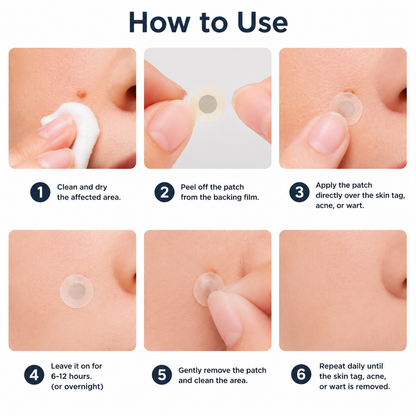 🏥 Curalona® Patch Invisible 2-en-1 🍀 | Cible les acrochordons, verrues planes et petites imperfections visibles | Micro-aiguilles + hydrocolloïde | Sans coupure • Sans congélation • Visage & corps