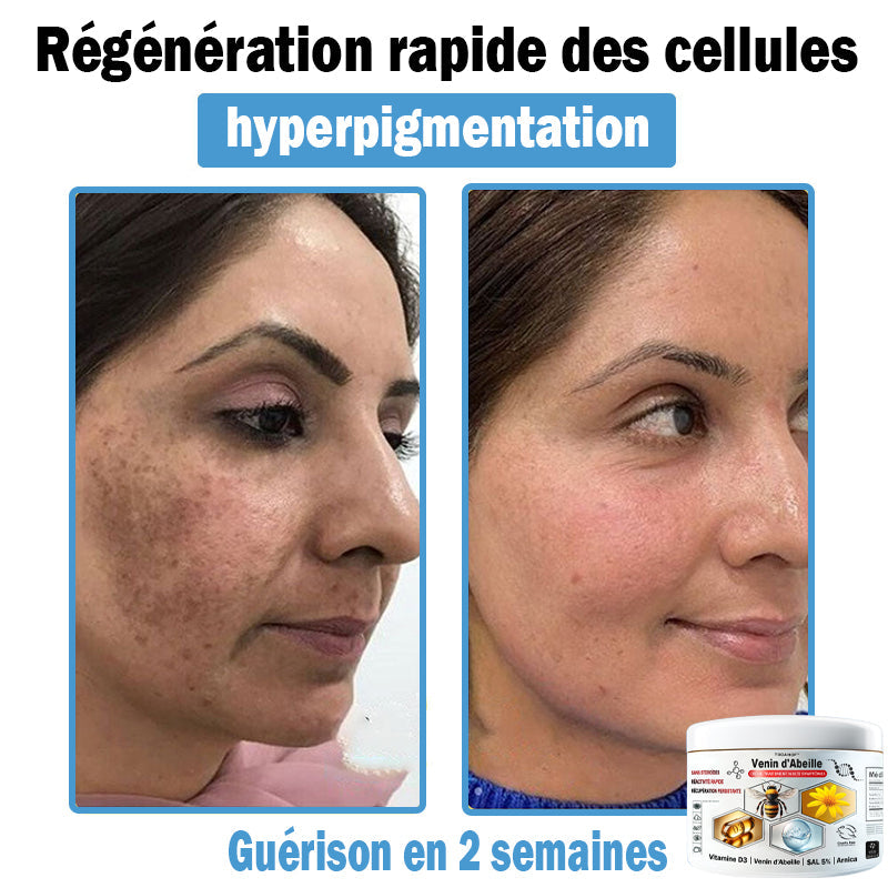 (⏰Promotion limitée : –60 % — Plus que 30 minutes ⏰)