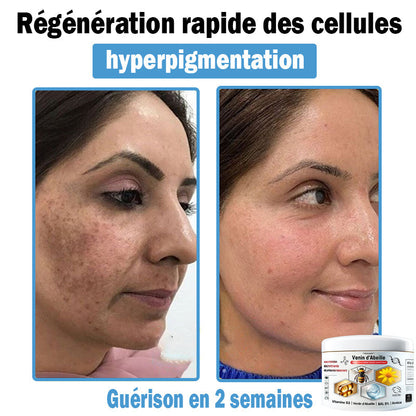 (⏰Promotion limitée : –60 % — Plus que 30 minutes ⏰)
