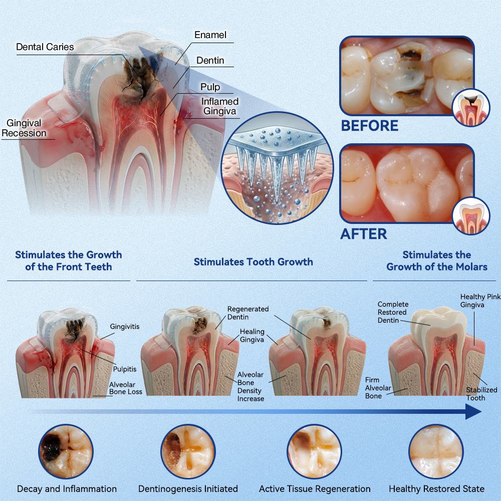 🏥 Pharmacie en ligne | Purelora® 😁 Bandes buccales à dissolution rapide au Tideglusib pour la réparation des dents et des gencives 🦷