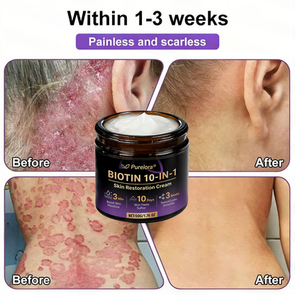 Fabriqué et expédié du France 🍁 Purelora® Crème Réparatrice Biotine 10-en-1 — Dernier Jour de Soldes : 75% de Réduction