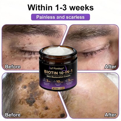 Fabriqué et expédié du France 🍁 Purelora® Crème Réparatrice Biotine 10-en-1 — Dernier Jour de Soldes : 75% de Réduction