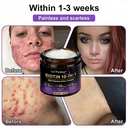 Fabriqué et expédié du France 🍁 Purelora® Crème Réparatrice Biotine 10-en-1 — Dernier Jour de Soldes : 75% de Réduction