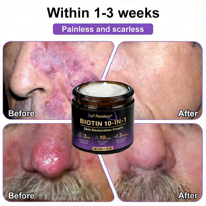 Fabriqué et expédié du France 🍁 Purelora® Crème Réparatrice Biotine 10-en-1 — Dernier Jour de Soldes : 75% de Réduction