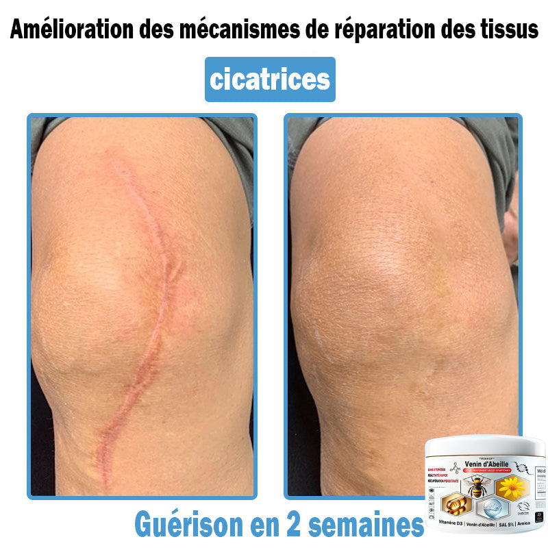 (⏰Promotion limitée : –60 % — Plus que 30 minutes ⏰)