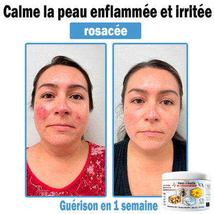 (⏰Promotion limitée : –60 % — Plus que 30 minutes ⏰)