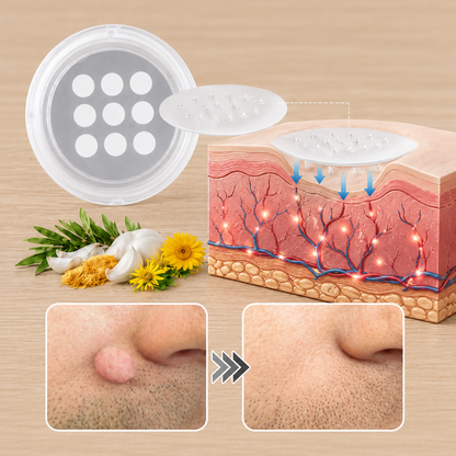 🏥 Curalona® Patch Invisible 2-en-1 🍀 | Cible les acrochordons, verrues planes et petites imperfections visibles | Micro-aiguilles + hydrocolloïde | Sans coupure • Sans congélation • Visage & corps