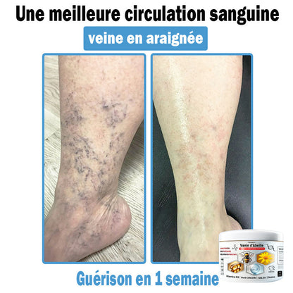 (⏰Promotion limitée : –60 % — Plus que 30 minutes ⏰)