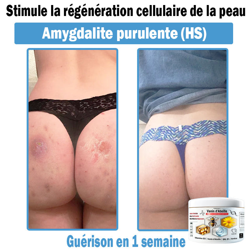 (⏰Promotion limitée : –60 % — Plus que 30 minutes ⏰)