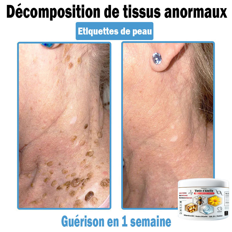 (⏰Promotion limitée : –60 % — Plus que 30 minutes ⏰)