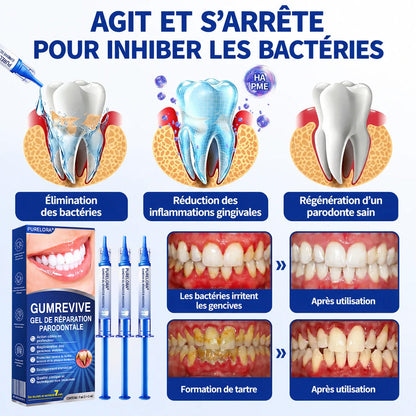 🧑‍⚕️🦷Purelora®  GumRevive Gel Réparateur Parodontal ✨